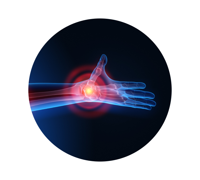 Рентген лучезапястного сустава Рентген лучезапястного сустава