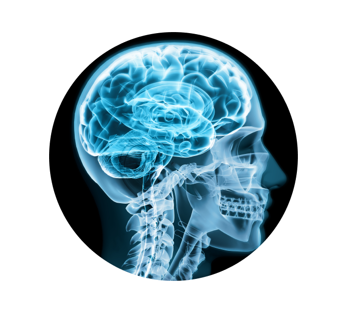 Рентген черепа Рентген черепа