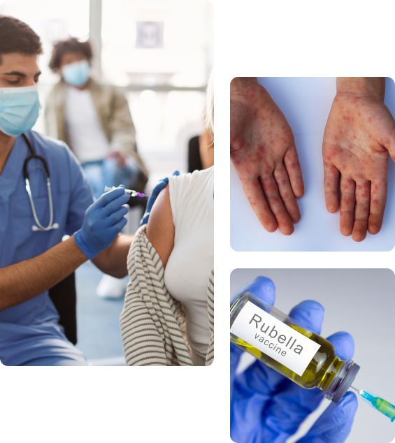 Осложнения после вакцинации от краснухи
