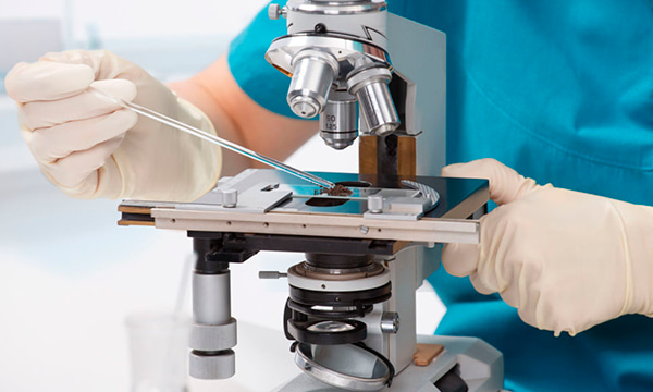 Анализ биоматериала на грибы Анализ биоматериала на грибы