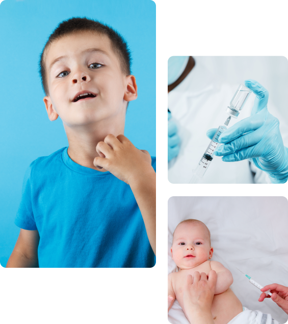 Осложнения после прививки от паротита детям