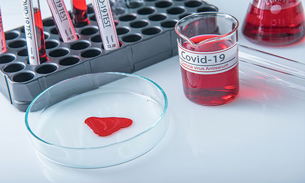 Экспресс-тестирование для обнаружения антигена вируса SARS-CoV-2 в мазках из носоглотки методом иммунохроматографического анализа (COVID-19 Ag); Экспресс-тестирование для обнаружения антигена вируса SARS-CoV-2 в мазках из носоглотки методом иммунохроматографического анализа (COVID-19 Ag);