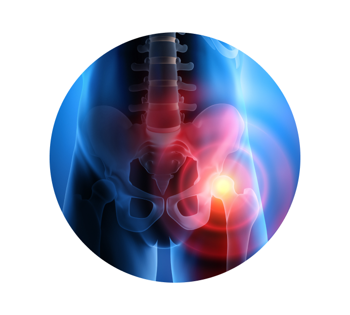 Рентген тазобедренного сустава Рентген тазобедренного сустава
