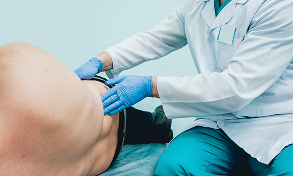 Сбор секрета простаты