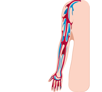 УЗИ вен верхних конечностей УЗИ вен верхних конечностей