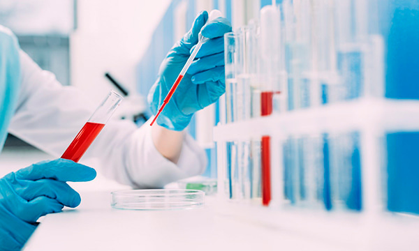 Исследование уровня фибриногена в крови