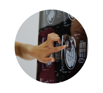 ТРГ (телерентгенограмма)