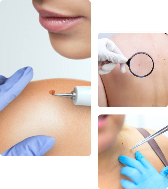 Осложнения после прививки от ВПЧ