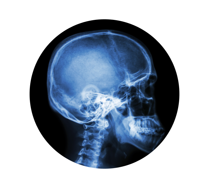 Рентген турецкого седла Рентген турецкого седла