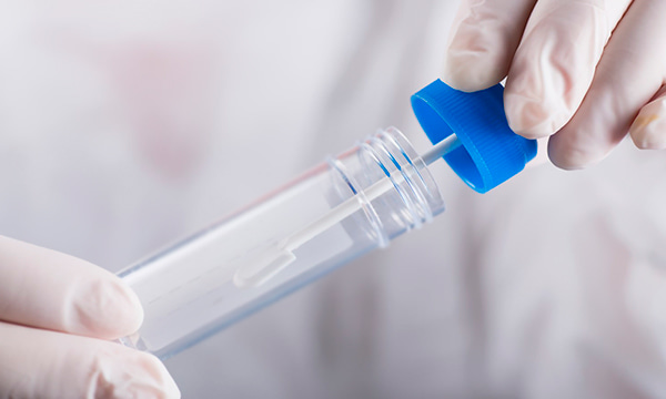 Анализ кала на эластазу Анализ кала на эластазу