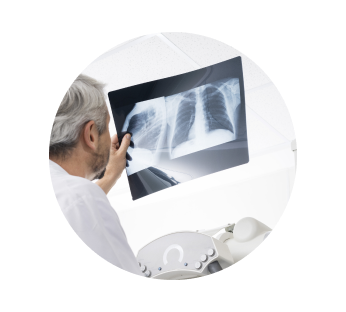 Рентген легких Рентген легких