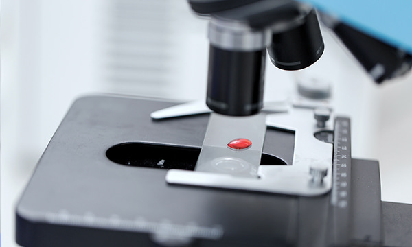 Анализ крови на билирубин (связанный)