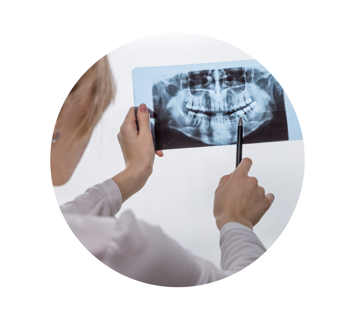 Рентген челюсти Рентген челюсти