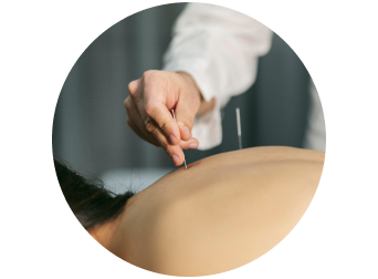 Рефлексотерапевт