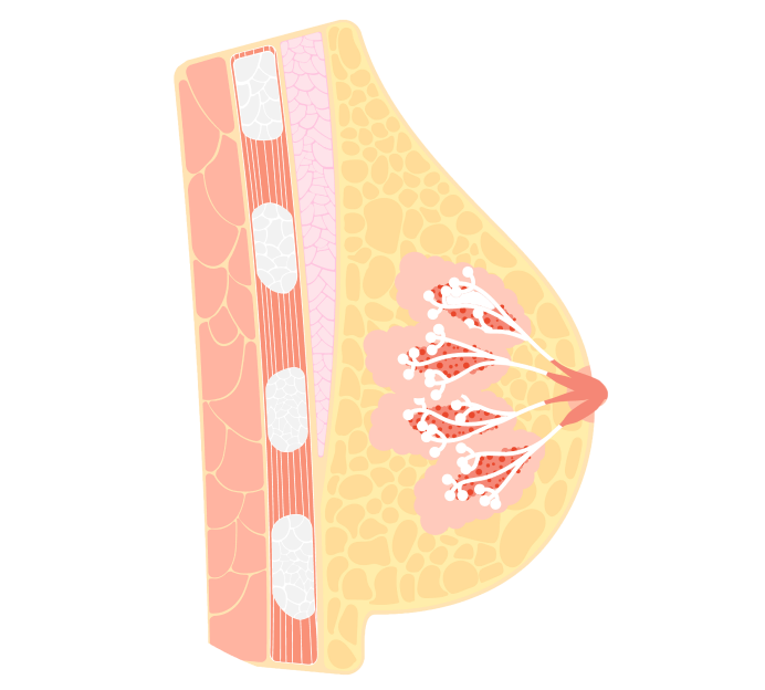 УЗИ молочных желез