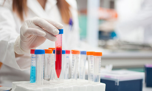 Определение Интерлейкина-6 (IL-6)