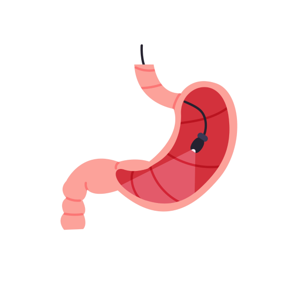 Подготовка к гастроскопии (ФГДС,ЭГДС)