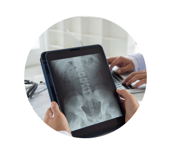 Рентген таза Рентген таза