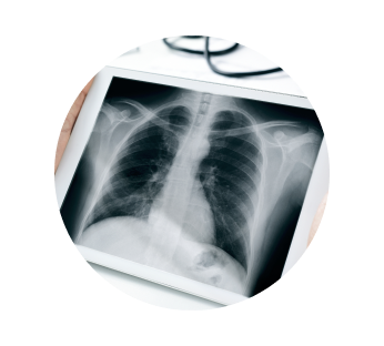 Подготовка к рентгену Подготовка к рентгену