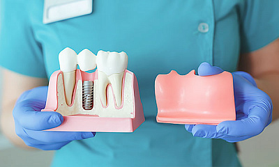 Гингивэктомия в области 1 зуба