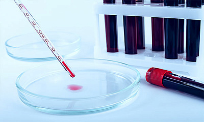 Анализ тромбоцитов в крови
