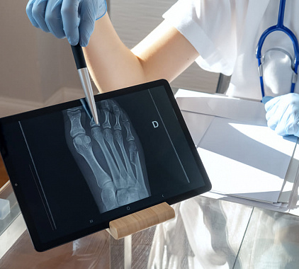 Рентгенография