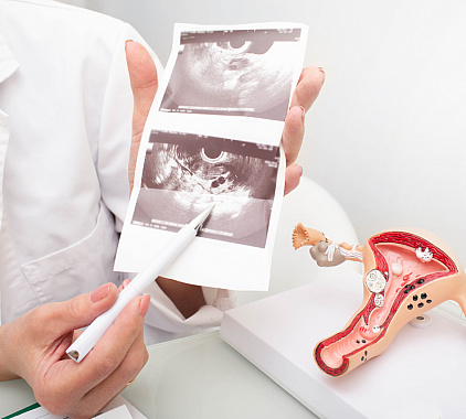 УЗИ маточных труб УЗИ маточных труб