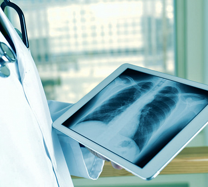 Рентгенография