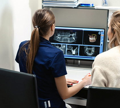 Рентгенография